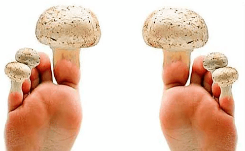 champignon de clou