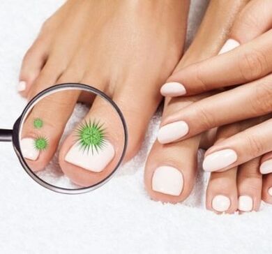 Infection des ongles à travers une loupe