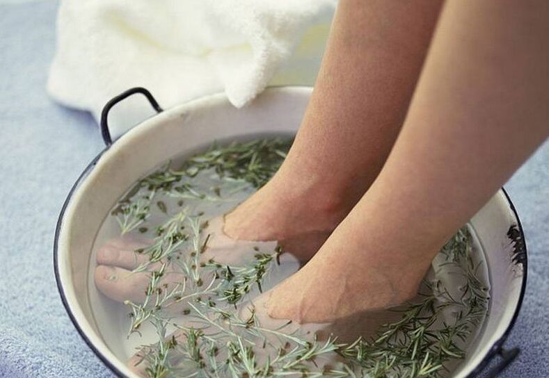 Bain avec décoction d'herbes pour mycose des ongles des pieds.