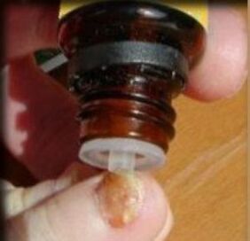 Appliquer des gouttes sur un ongle affecté par un champignon