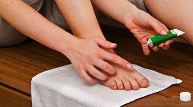 traitement des champignons des ongles avec une pommade